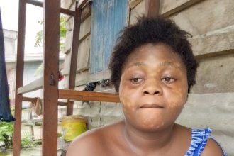 Karène abandonnée à son sort à Douala